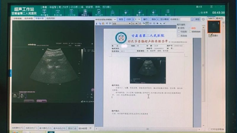 老年人体检套餐哪家医院好